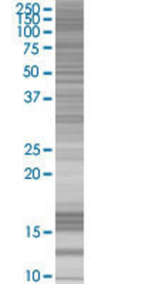 USF1 transfected lysate.