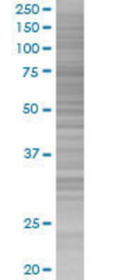 SLC40A1 transfected lysate.