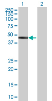 Lane 1: SLC40A1 transfected lysate (62.92 KDa) Lane 2: Non-transfected lysate.