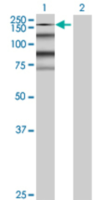 Lane 1: KIAA0460 transfected lysate (156.75 KDa) Lane 2: Non-transfected lysate.