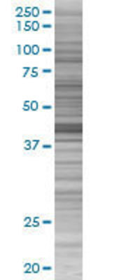 RSAFD1 transfected lysate.