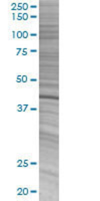 GMPPA transfected lysate.
