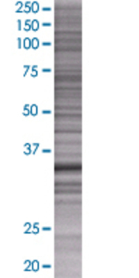 SHARPIN transfected lysate.