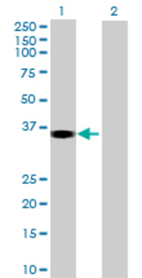 Lane 1: SHARPIN transfected lysate (35.97 KDa) Lane 2: Non-transfected lysate.