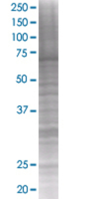 DDX5 transfected lysate.