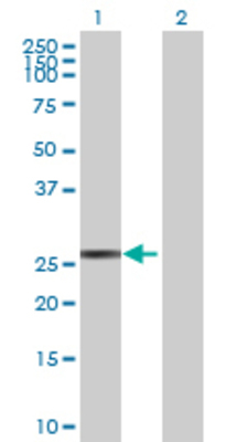 Lane 1: CYB5R2 transfected lysate (26.18 KDa) Lane 2: Non-transfected lysate.