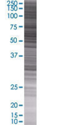 OXCT1 transfected lysate.