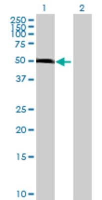 Lane 1: OXCT1 transfected lysate (57.31 KDa) Lane 2: Non-transfected lysate.