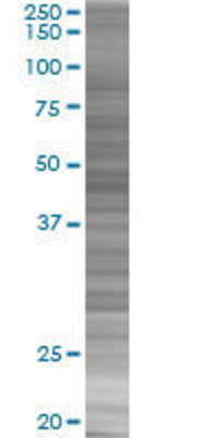 FKBP5 transfected lysate.