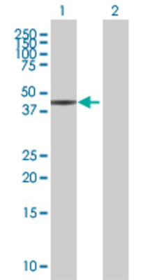 Lane 1: EPB49 transfected lysate (43.1 KDa) Lane 2: Non-transfected lysate.