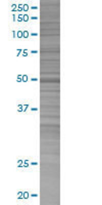 WDR41 transfected lysate.