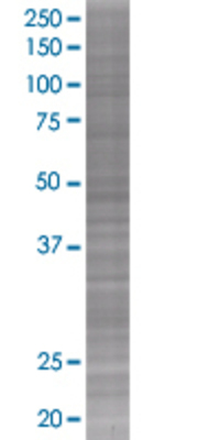 DECR2 transfected lysate.