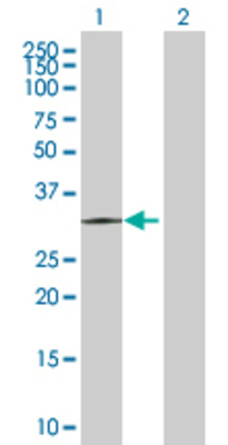 Lane 1: DECR2 transfected lysate (30.8 KDa) Lane 2: Non-transfected lysate.