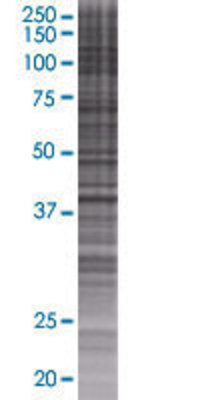 DDO transfected lysate.