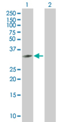 Lane 1: VAPB transfected lysate (26.73 KDa) Lane 2: Non-transfected lysate.