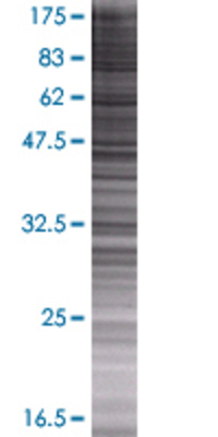 POLR3F transfected lysate.