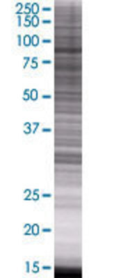 RASAL1 transfected lysate.