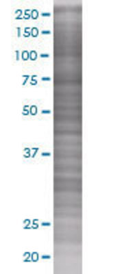 SOCS5 transfected lysate.