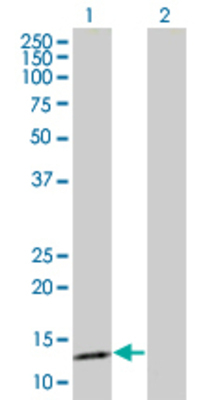 Lane 1: SNCG transfected lysate (14.08 KDa) Lane 2: Non-transfected lysate.