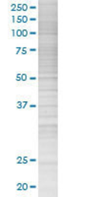 SNCG transfected lysate.