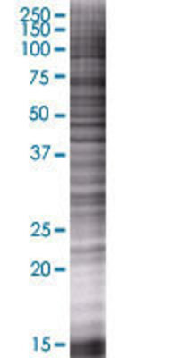 TNFRSF13C transfected lysate.