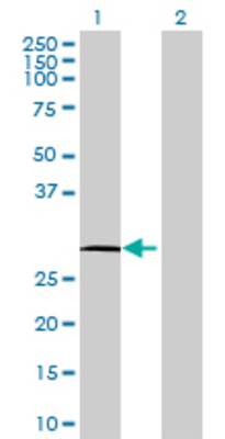 Lane 1: TNFRSF13C transfected lysate (20.35 KDa) Lane 2: Non-transfected lysate.