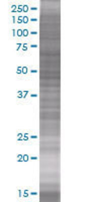 RING1 transfected lysate.