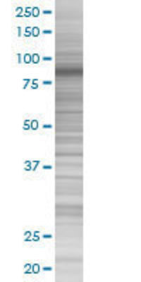 EPS8 transfected lysate.