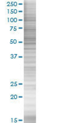 LPL transfected lysate.