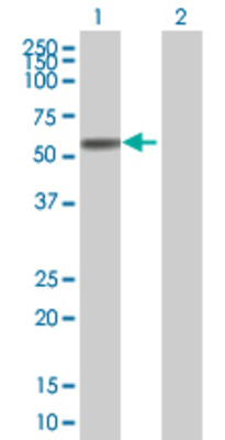 Lane 1: LPL transfected lysate (53.2 KDa) Lane 2: Non-transfected lysate.