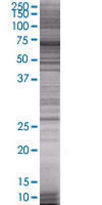 MTHFD2 transfected lysate.