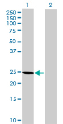 Lane 1: MTHFD2 transfected lysate (27.39 KDa) Lane 2: Non-transfected lysate.