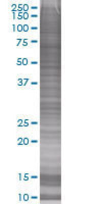 C1QTNF6 transfected lysate