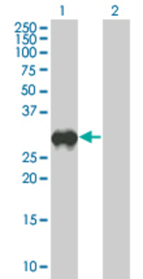 Lane 1: C1QTNF6 transfected lysate (27.28 KDa). Lane 2: Non-transfected lysate.