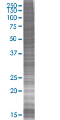 GTF2F2 transfected lysate