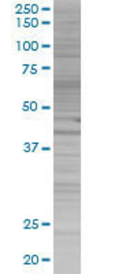 HMBS transfected lysate.