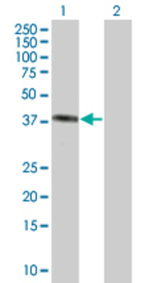 Lane 1: HMBS transfected lysate (39.82 KDa) Lane 2: Non-transfected lysate.