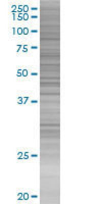 STEAP1 transfected lysate.