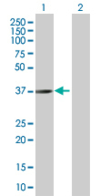 Lane 1: STEAP1 transfected lysate (39.9 KDa) Lane 2: Non-transfected lysate.