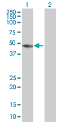 Lane 1: CPB2 transfected lysate (48.4 KDa). Lane 2: Non-transfected lysate.
