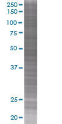 CPB2 transfected lysate