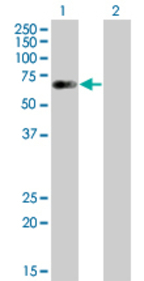 Lane 1: CTNND1 transfected lysate (67.1 KDa) Lane 2: Non-transfected lysate.