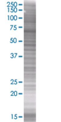 CTNND1 transfected lysate.