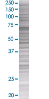 TDP1 transfected lysate.