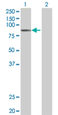 Lane 1: TDP1 transfected lysate (68.4 KDa) Lane 2: Non-transfected lysate.