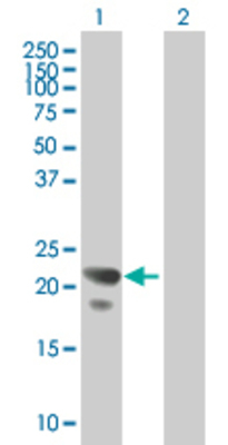 Lane 1: COPS8 transfected lysate (23.1 KDa). Lane 2: Non-transfected lysate.