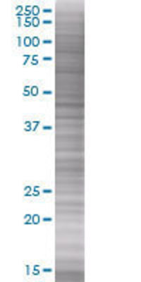 CCDC5 transfected lysate