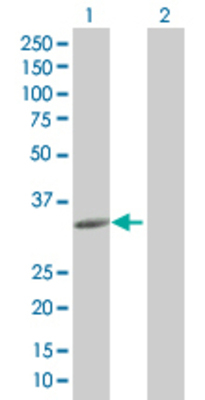 Lane 1: CCDC5 transfected lysate (31.9 KDa). Lane 2: Non-transfected lysate.