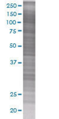 ANGPTL4 transfected lysate.