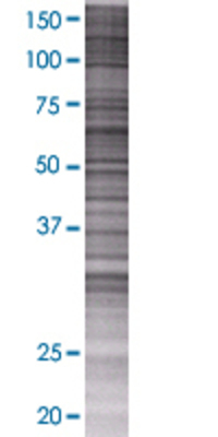 DAK transfected lysate.